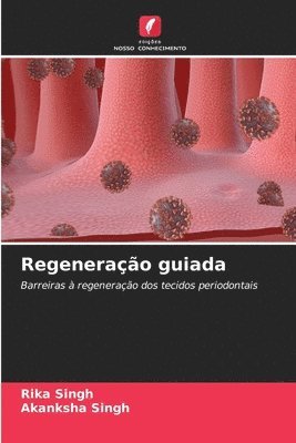 Regenerao guiada 1