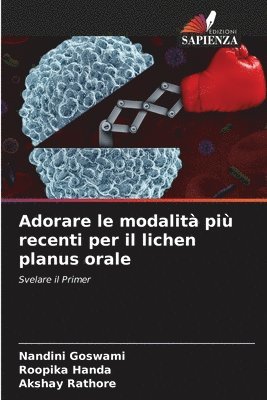 Adorare le modalit pi recenti per il lichen planus orale 1