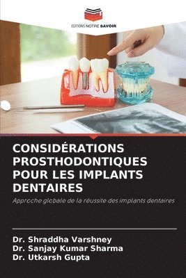 Considrations Prosthodontiques Pour Les Implants Dentaires 1