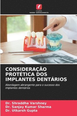 Considerao Prottica DOS Implantes Dentrios 1
