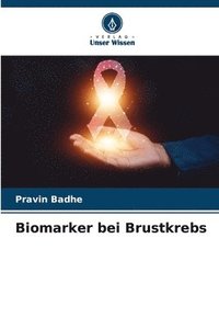 bokomslag Biomarker bei Brustkrebs