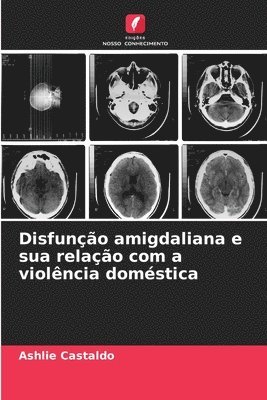 bokomslag Disfuno amigdaliana e sua relao com a violncia domstica