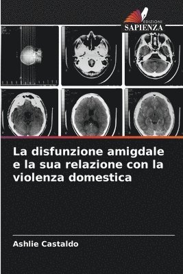 La disfunzione amigdale e la sua relazione con la violenza domestica 1