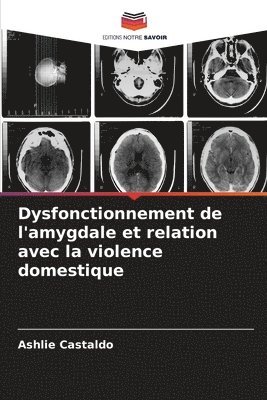 bokomslag Dysfonctionnement de l'amygdale et relation avec la violence domestique