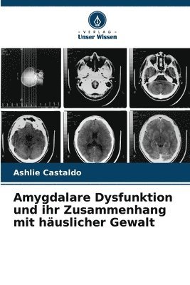 bokomslag Amygdalare Dysfunktion und ihr Zusammenhang mit huslicher Gewalt