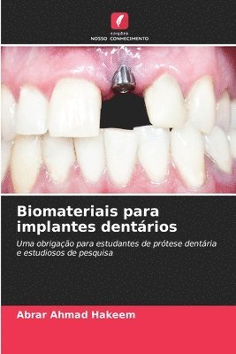 Biomateriais para implantes dentrios 1