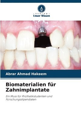 Biomaterialien fr Zahnimplantate 1