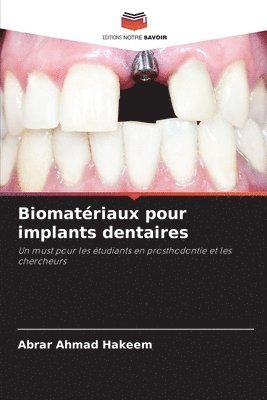 Biomatriaux pour implants dentaires 1