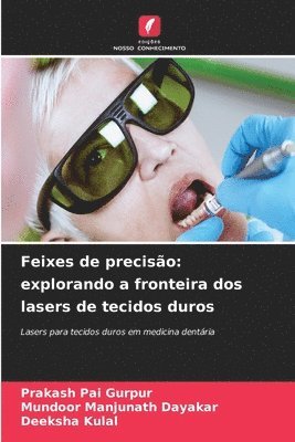 Feixes de preciso 1