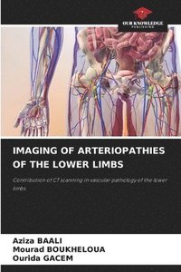 bokomslag Imaging of Arteriopathies of the Lower Limbs