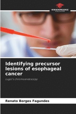 Identifying precursor lesions of esophageal cancer 1