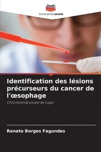 bokomslag Identification des lsions prcurseurs du cancer de l'oesophage