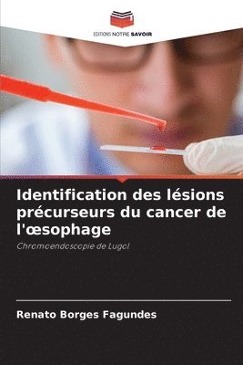 Identification des lsions prcurseurs du cancer de l'oesophage 1