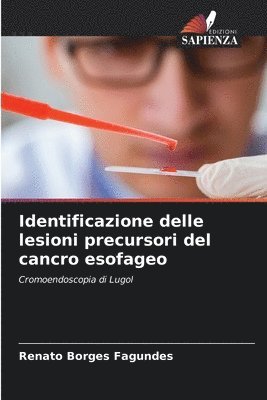 bokomslag Identificazione delle lesioni precursori del cancro esofageo