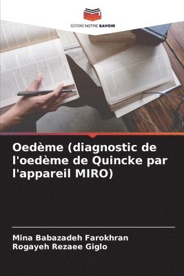 bokomslag Oedème (diagnostic de l'oedème de Quincke par l'appareil MIRO)
