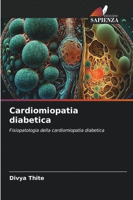 Cardiomiopatia diabetica 1