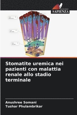 bokomslag Stomatite uremica nei pazienti con malattia renale allo stadio terminale