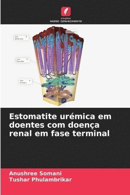 Estomatite urmica em doentes com doena renal em fase terminal 1
