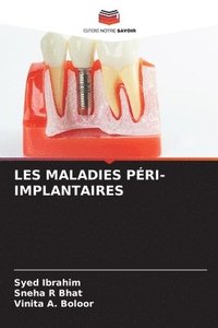 bokomslag Les Maladies Pri-Implantaires