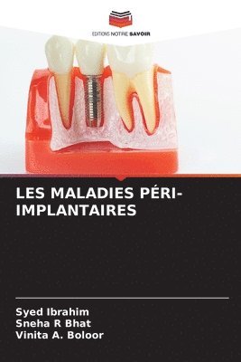 Les Maladies Pri-Implantaires 1