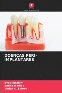 bokomslag Doenas Peri-Implantares