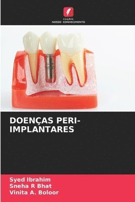 Doenas Peri-Implantares 1