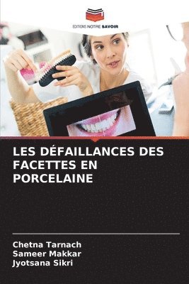 Les Dfaillances Des Facettes En Porcelaine 1