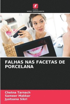 bokomslag Falhas NAS Facetas de Porcelana