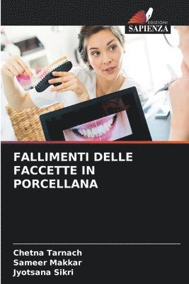 bokomslag Fallimenti Delle Faccette in Porcellana