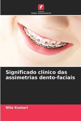 Significado clnico das assimetrias dento-faciais 1