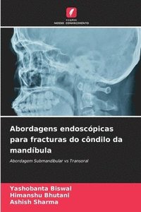 bokomslag Abordagens endoscpicas para fracturas do cndilo da mandbula