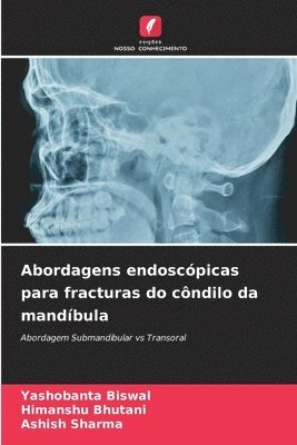 bokomslag Abordagens endoscpicas para fracturas do cndilo da mandbula