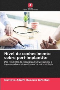 bokomslag Nvel de conhecimento sobre peri-implantite