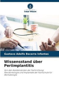 bokomslag Wissensstand ber Periimplantitis