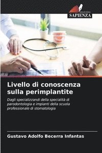 bokomslag Livello di conoscenza sulla perimplantite