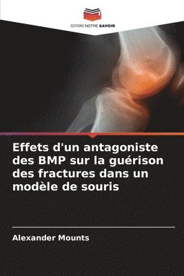 bokomslag Effets d'un antagoniste des BMP sur la gurison des fractures dans un modle de souris