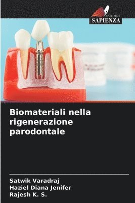 Biomateriali nella rigenerazione parodontale 1