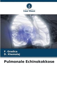 bokomslag Pulmonale Echinokokkose