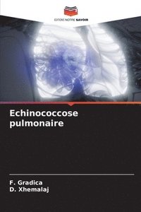 bokomslag Echinococcose pulmonaire