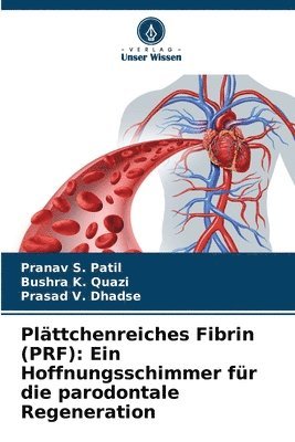 Plttchenreiches Fibrin (PRF) 1