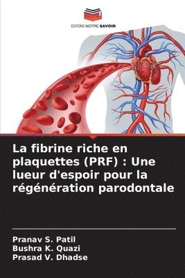 La fibrine riche en plaquettes (PRF) 1