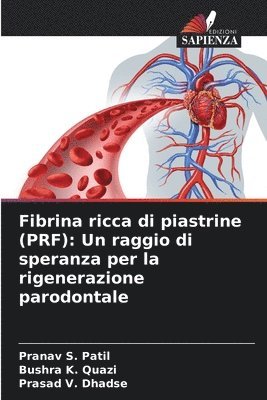 bokomslag Fibrina ricca di piastrine (PRF)