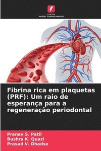 bokomslag Fibrina rica em plaquetas (PRF)