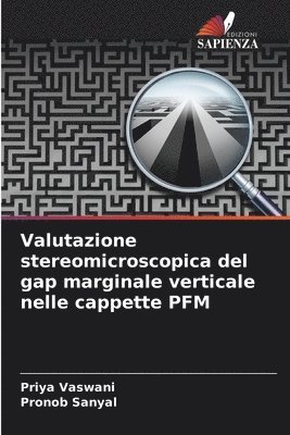 Valutazione stereomicroscopica del gap marginale verticale nelle cappette PFM 1