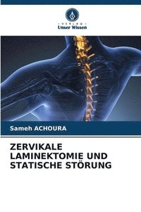 bokomslag Zervikale Laminektomie Und Statische Strung