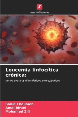 Leucemia linfoctica crnica 1