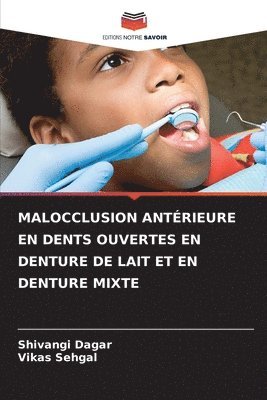 Malocclusion Antrieure En Dents Ouvertes En Denture de Lait Et En Denture Mixte 1