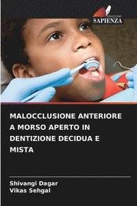 bokomslag Malocclusione Anteriore a Morso Aperto in Dentizione Decidua E Mista