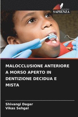 bokomslag Malocclusione Anteriore a Morso Aperto in Dentizione Decidua E Mista