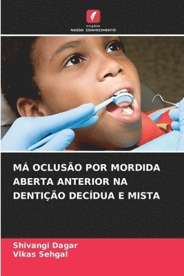 bokomslag M Ocluso Por Mordida Aberta Anterior Na Dentio Decdua E Mista